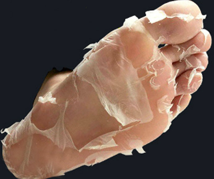 Deep Exfoliation Foot Peel